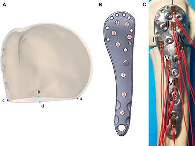 Finite element analysis and biomechanical study of “sandwich” fixation in the treatment of elderly proximal humerus fractures